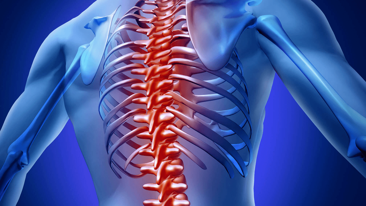 osteocondrose da coluna torácica