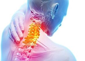 causas de osteocondrose cervical